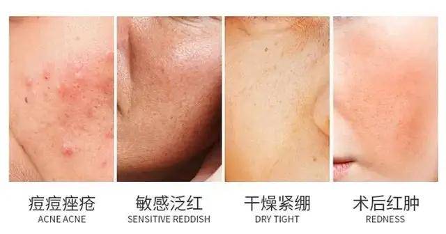 一篇就不会买错药妆了pg电子入口看完这(图5)